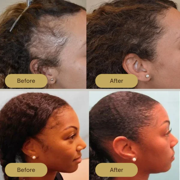 Veganic Americ - Natural Hair Growth Oil - Image 3